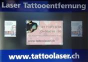 Tattooentfernung-sg.com